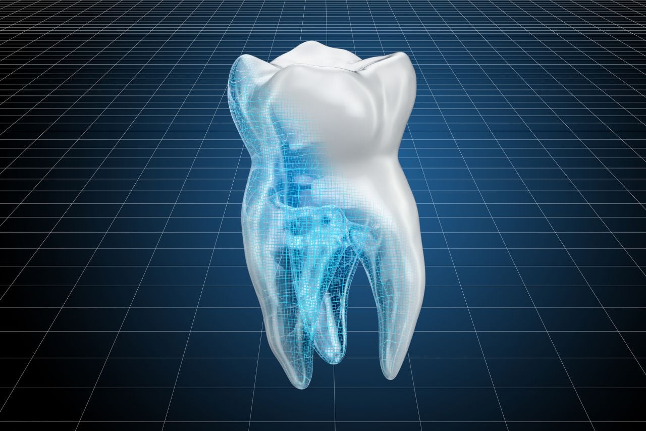 3D Imaging CBCT