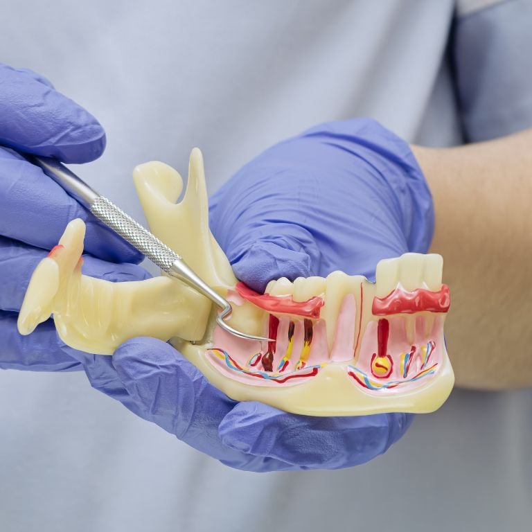 Alani Dental Periodontal Treatment Overview