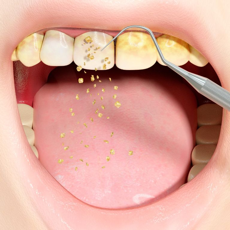  https://alanidentistry.com/lanap-periodontal/gum-disease-treatment/