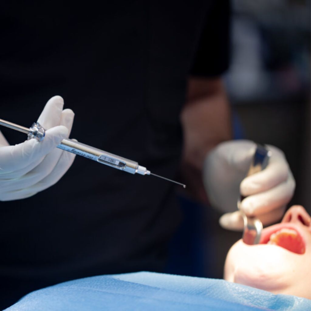 IV Sedation Treatment at Alani Dental