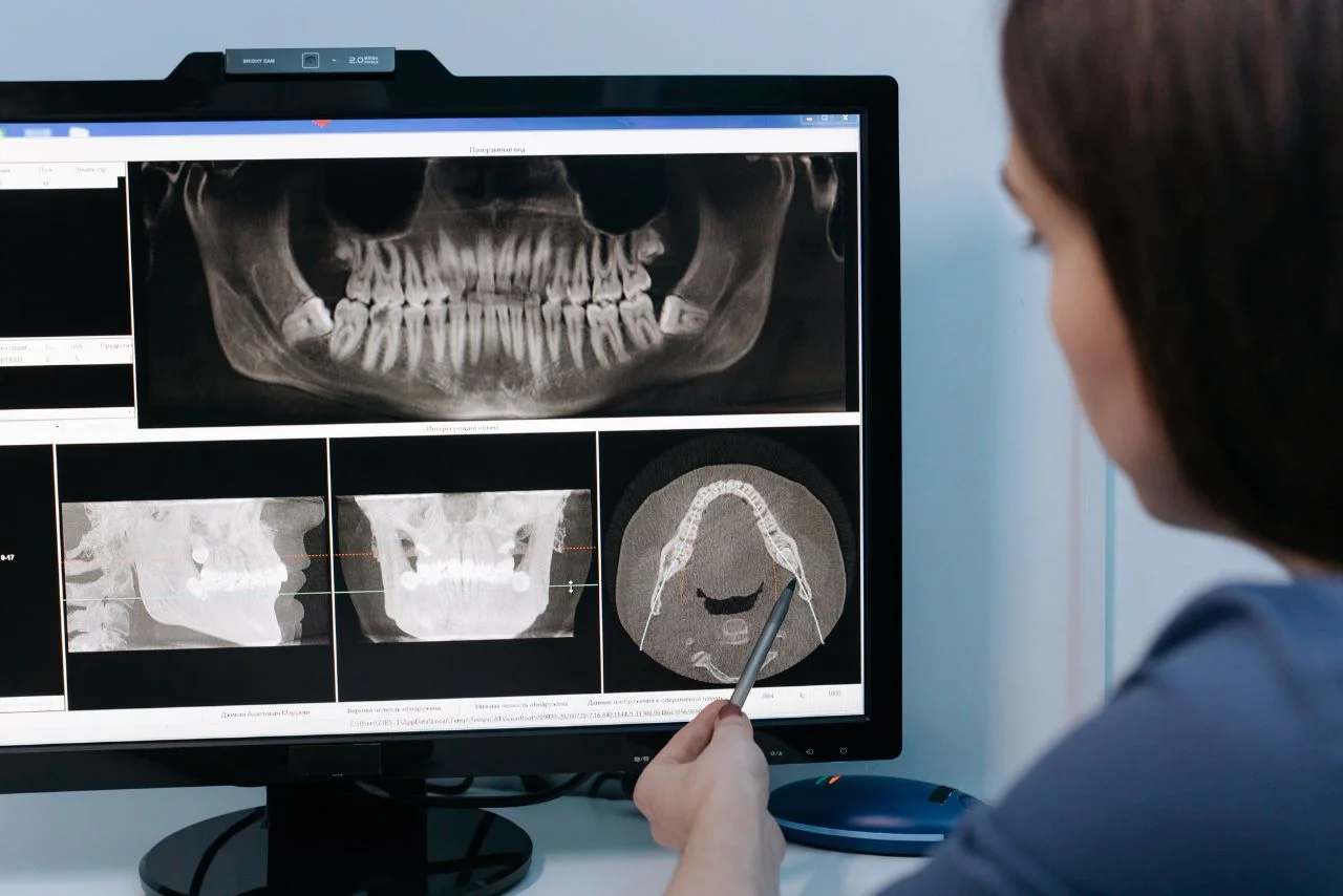 Modern Digital Dental Imaging at Alani Dental