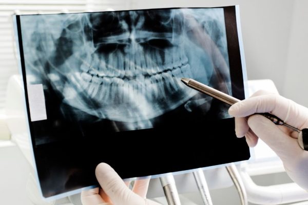 Digital X-rays & CBCT Imaging