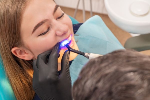 LANAP Laser Gum Treatment